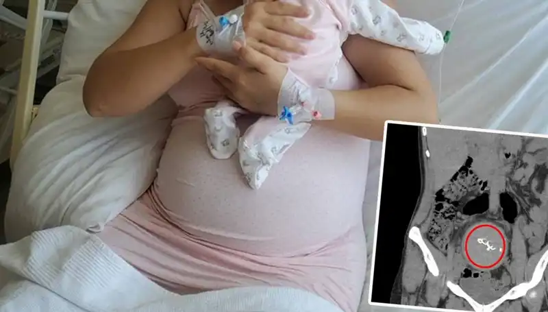 Doğumda Unutulduğu İddia Edilen Bebeğin Hikayesi: Gazlı Bez İhmaline Soruşturma