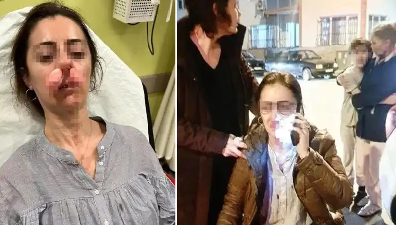Eşinin Sevgilisi Sandığı Araç Kapısıyla Saldırdı: Otomobil Kapısı Silah Sayıldı!