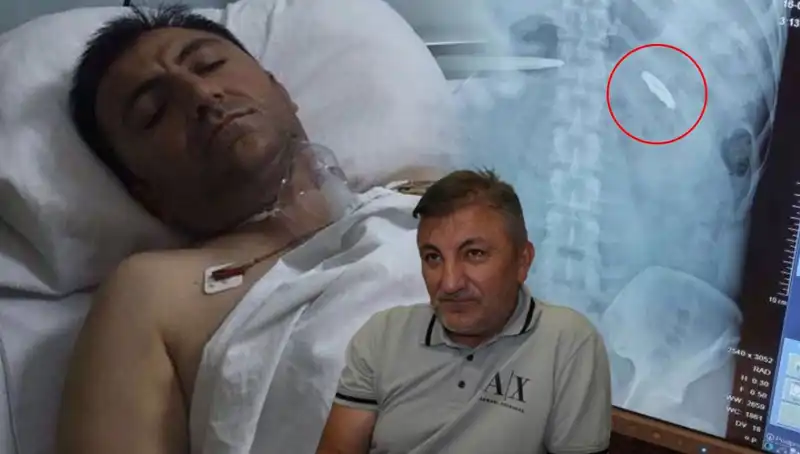 15 Temmuz'un Karanlık Gece'sinde Vücudunda Kurşun Taşıyan Kahramanların Hikayesi