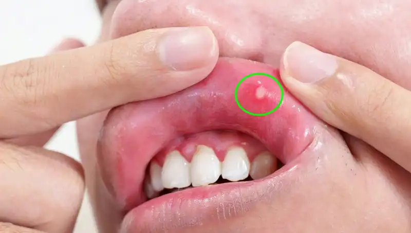 B Vitaminleri Eksikliğinin 5 Belirgin İşareti: Vücudunuzun Sesi