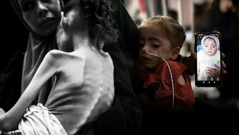 Küçük Meryem'in Zorlu Mücadelesi: 25 Kilodan 10 Kiloya Düşüşün Arkasındaki Ağır Hikaye