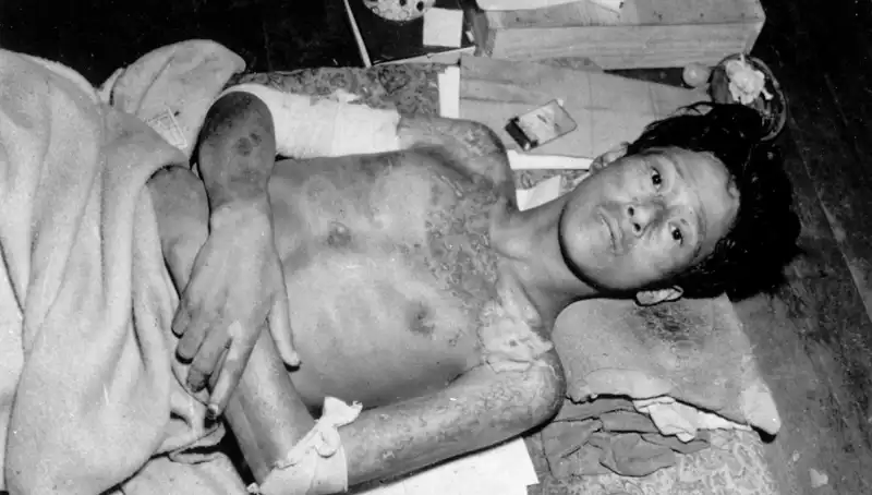 80 Yıl Sonra Nagasaki'den Felaket Uyarısı: Nükleer Tehdit Artıyor