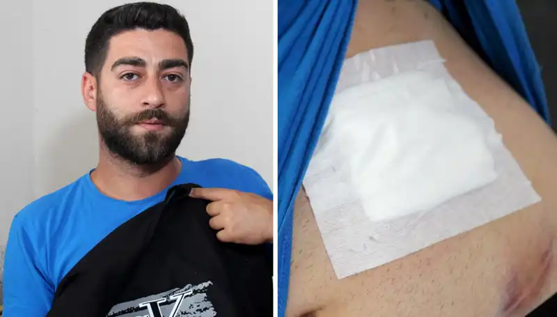 Karnındaki Ağrının Sebebini Öğrenen Kadının Şaşırtan Hikayesi